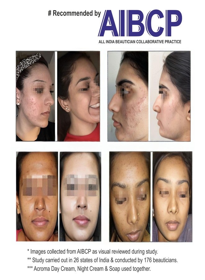 ACROMA NIGHT CREAM (30 + 30 GM) # Recommended by All India Beautician Collaborative Practice (AIBCP) - Pack of 2 - Image 3