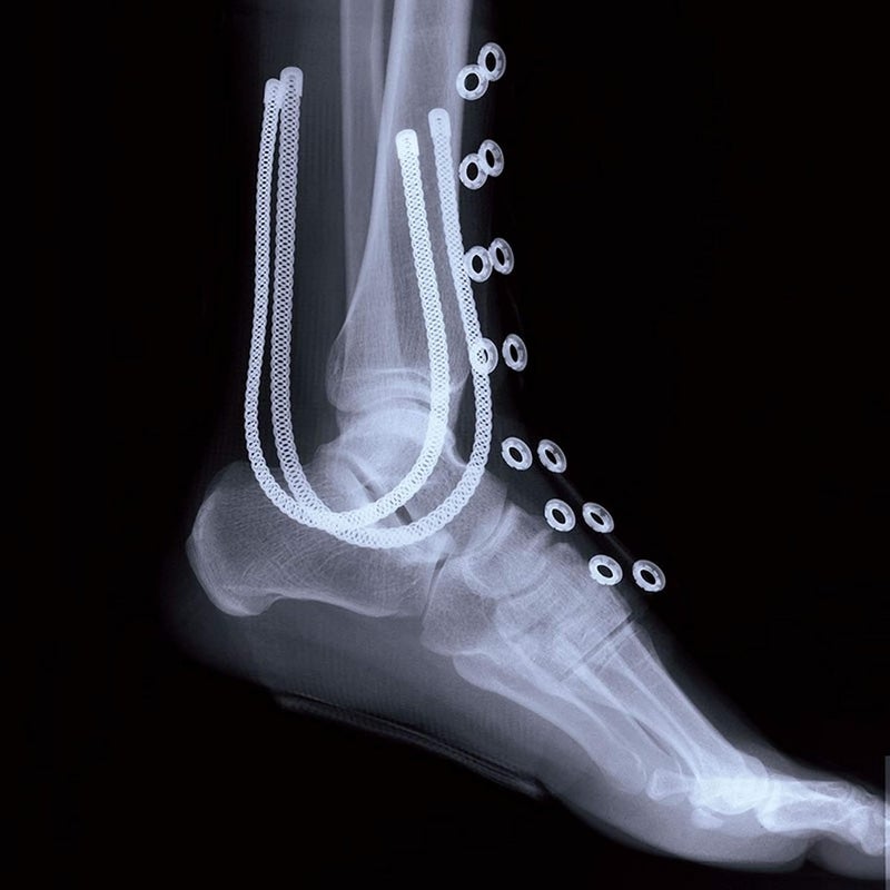 LP Support 787 High-Performance Ankle Brace - Image 3