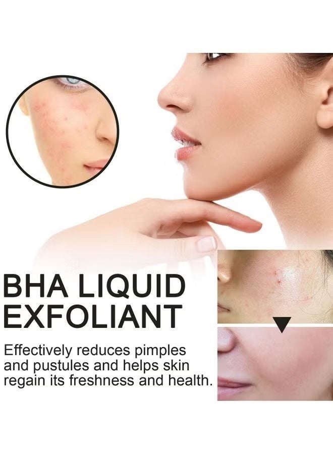 هويجي الجلد الكمال السائل التقشير الأسود والأبيض 118ml - Image 2