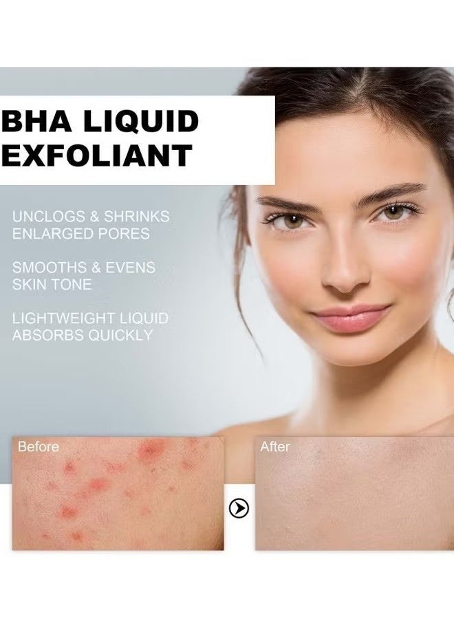 هويجي الجلد الكمال السائل التقشير الأسود والأبيض 118ml - Image 4