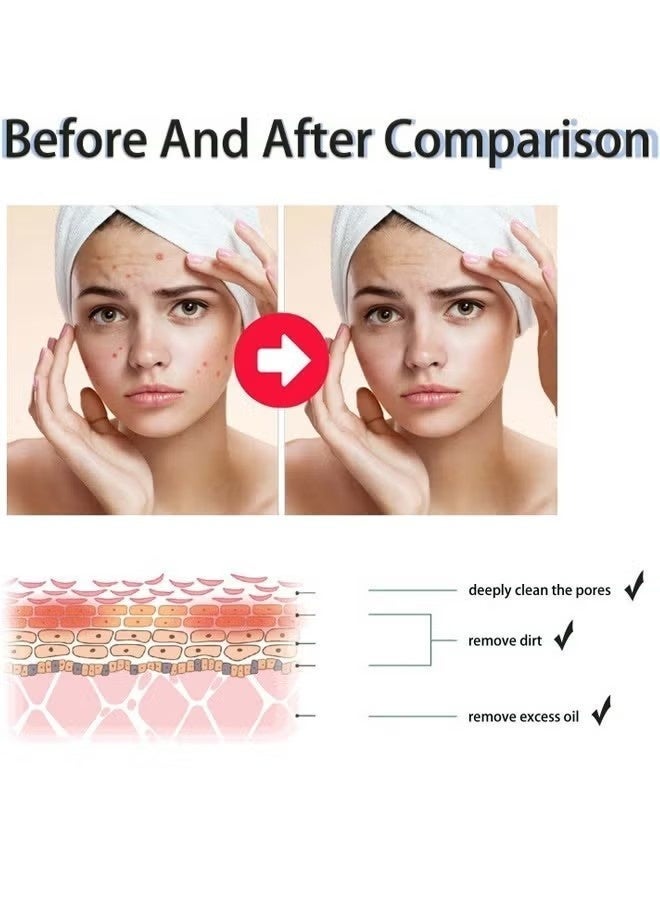 هويجي الجلد الكمال السائل التقشير الأسود والأبيض 118ml - Image 3