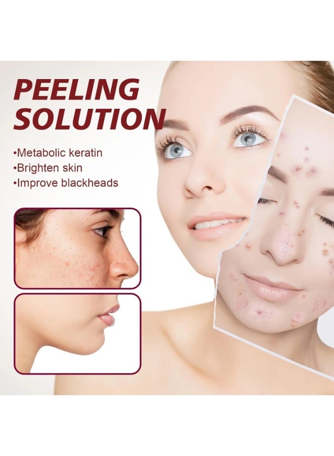 BeautyVoc AHA 30% + BHA 20% Peeling Solution, Fades Pigmentation & Dark Spots, 30ml - Image 4
