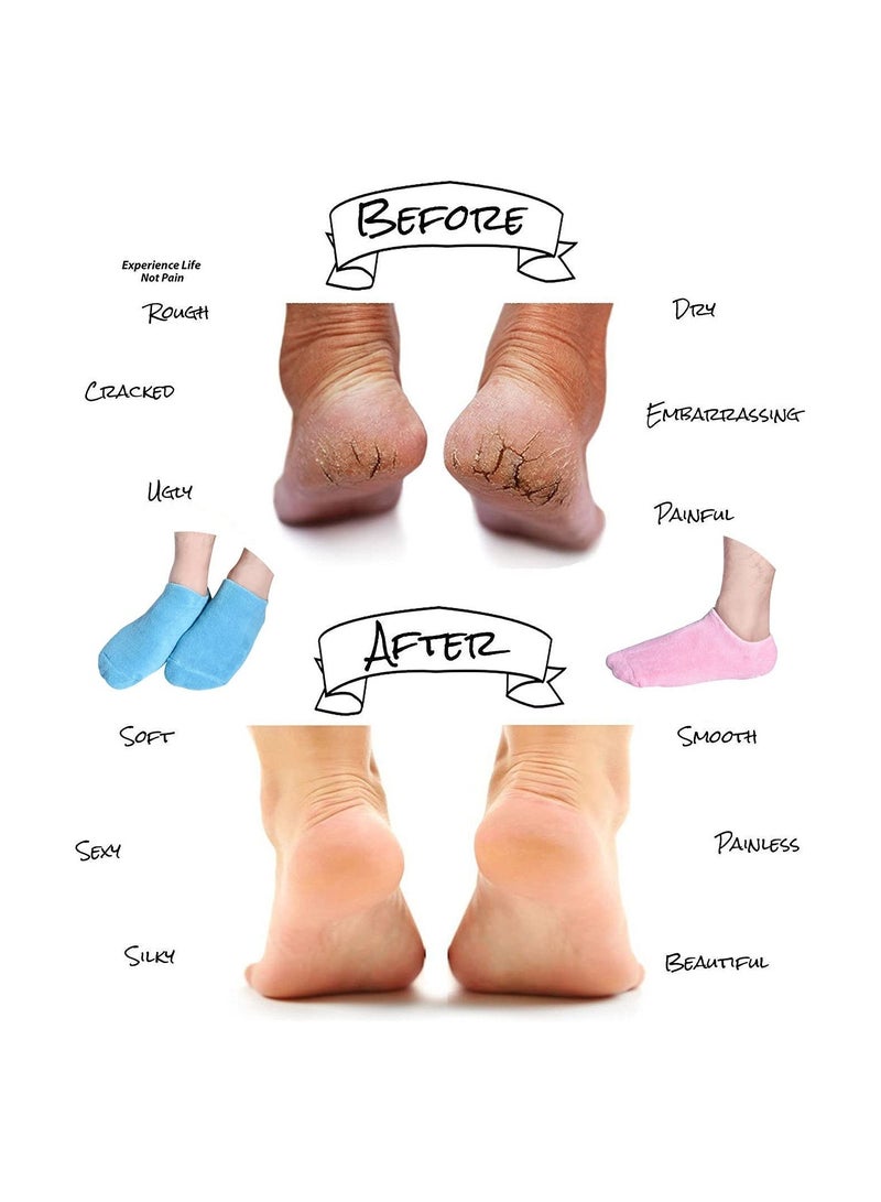 Gonice Moisturizing Gloves Socks Set Gel Spa for Moisturize Soften Repairing Dry Hands Feet Cracked Skin Care Silicone inside - Image 3