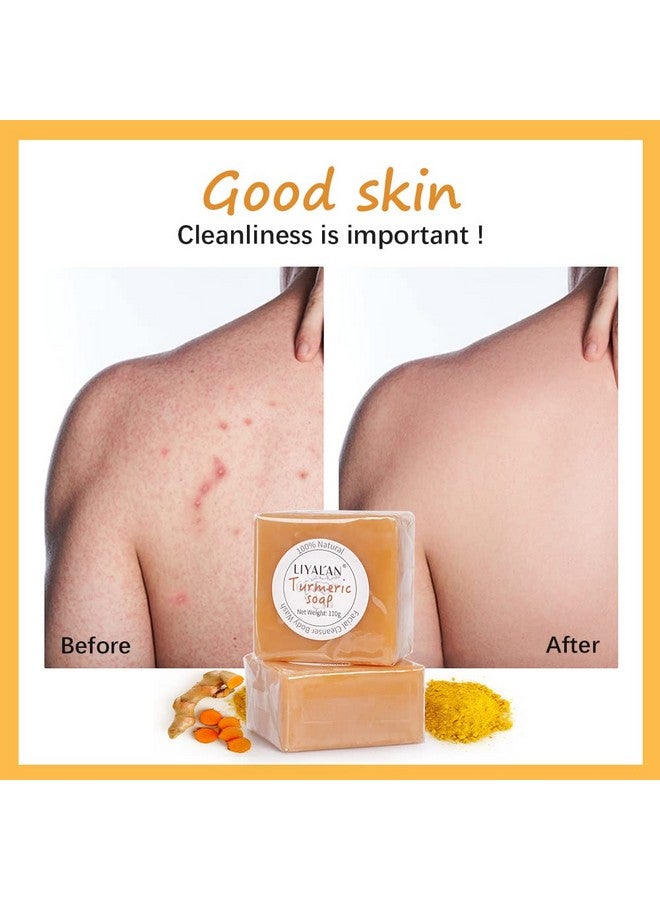 LIYALAN Turmeric Soap Bar For Face & Bodytumeric Soapacne Dark Spots Smooth Skindeep Cleansing Natural Handmade Soap - Image 5