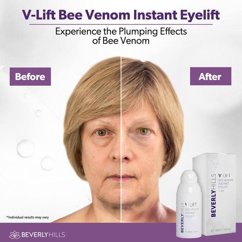 Beverly Hills V-Lift Instant Eye Lift and Eye Tuck Bee Venom Serum for Puffy Eyes, Dark Circles, Wrinkles, and Under Eye Bags Treatment for Women and Men | 30mL (120 Day Supply) - Image 5