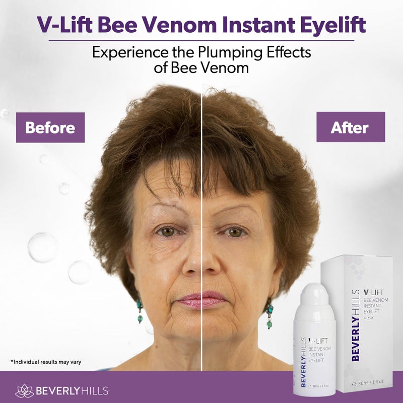 Beverly Hills V-Lift Instant Eye Lift and Eye Tuck Bee Venom Serum for Puffy Eyes, Dark Circles, Wrinkles, and Under Eye Bags Treatment for Women and Men | 30mL (120 Day Supply) - Image 3