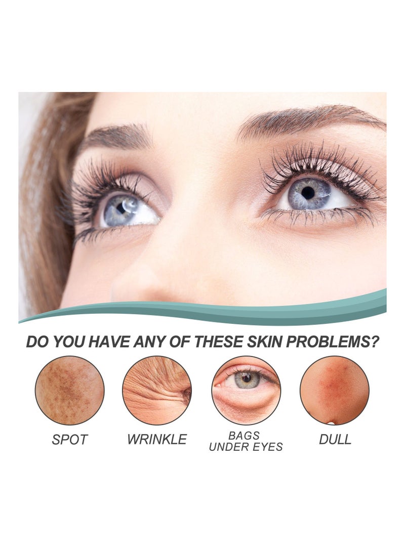 EELHOE Dark Spot Corrector Dark Spot Remover for Face and Body - Black Spot Fade Cream with Niacinamide - Prevent Forming Dark Spots Fade Spots Improve Skin Tone - Image 2