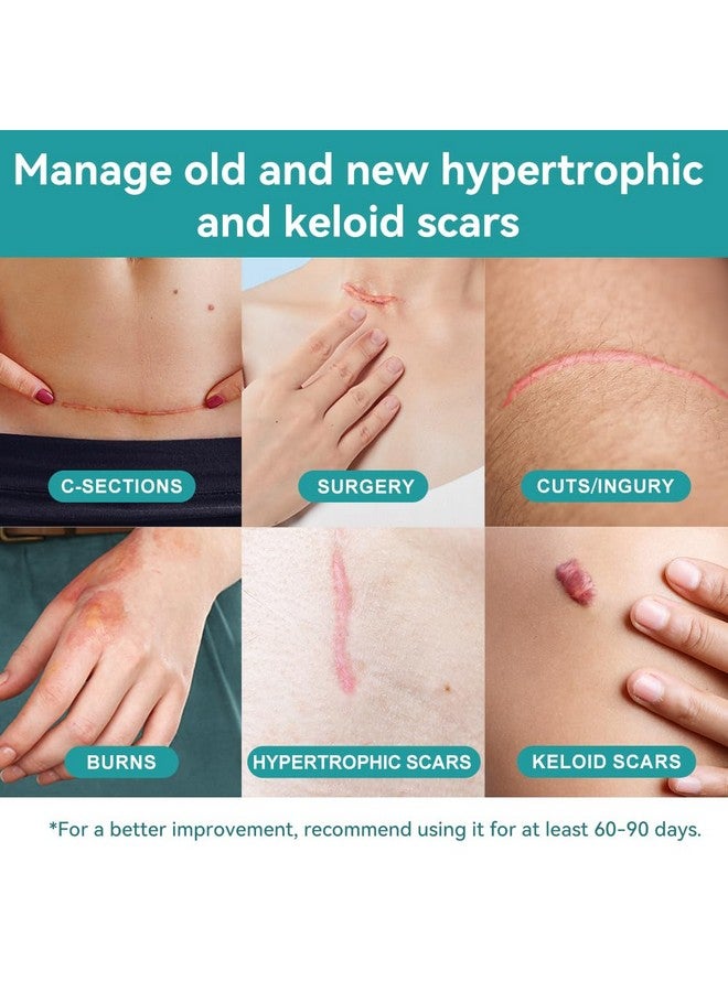 Dimora Waterproof Silicone Scar Sheets - Medical Grade Silicone Scar Tape (1.6”x120" Roll), Ultra-thin Scar Removal Treatment for Surgical Scars, C Section, Tummy Tuck, Keloid Treatment - Image 2