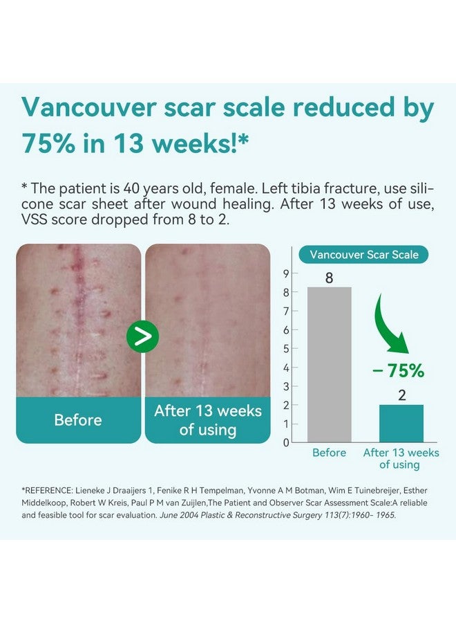 Dimora Waterproof Silicone Scar Sheets - Medical Grade Silicone Scar Tape (1.6”x120" Roll), Ultra-thin Scar Removal Treatment for Surgical Scars, C Section, Tummy Tuck, Keloid Treatment - Image 3