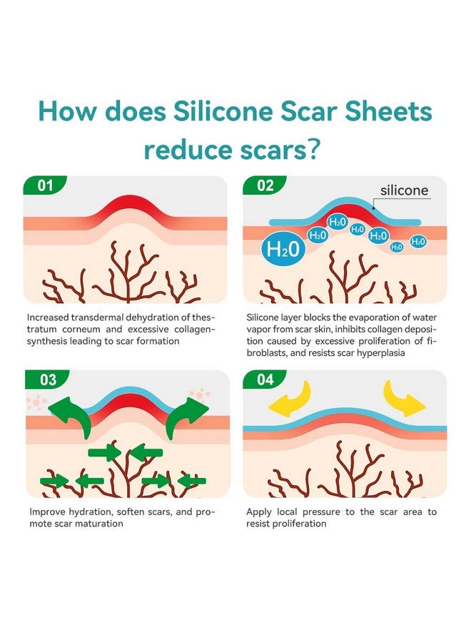 Dimora Waterproof Silicone Scar Sheets - Medical Grade Silicone Scar Tape (1.6”x120" Roll), Ultra-thin Scar Removal Treatment for Surgical Scars, C Section, Tummy Tuck, Keloid Treatment - Image 5
