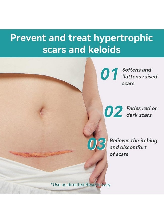 Dimora Waterproof Silicone Scar Sheets - Medical Grade Silicone Scar Tape (1.6”x120" Roll), Ultra-thin Scar Removal Treatment for Surgical Scars, C Section, Tummy Tuck, Keloid Treatment - Image 4