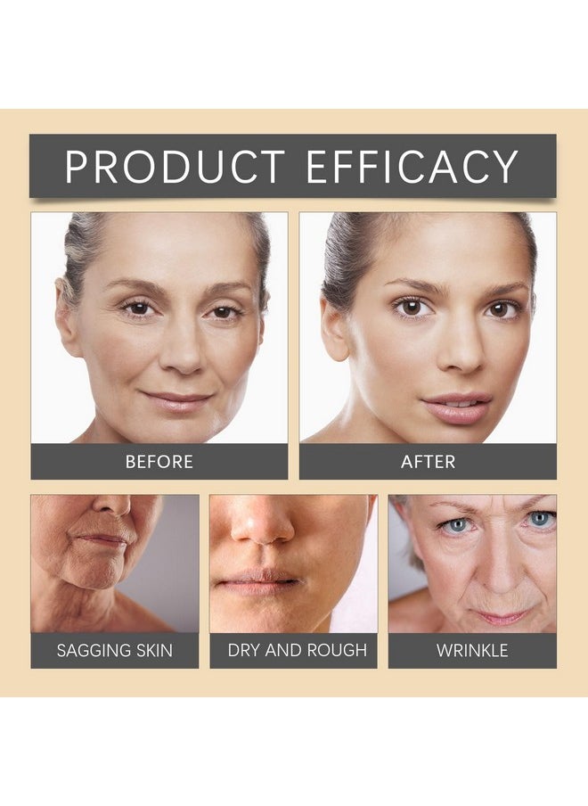 Deuiosna Deuiosna Botox Bee Venom Wrinkle Removal Cream, Bee Venom Anti-Wrinkle Firming Cream,Moisturizing, Lifting & Recovery - All Skin Types - Anti-Aging 2bottle  - Image 5