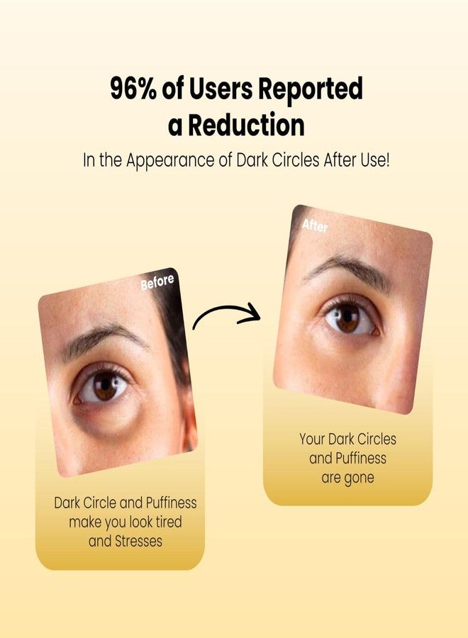 Eyecirque Under EYE Gel Serum - (60g) Twin pack for Dark Circles, Puffiness | 96% Users Reported a Reduction of Dark Circles - Image 5