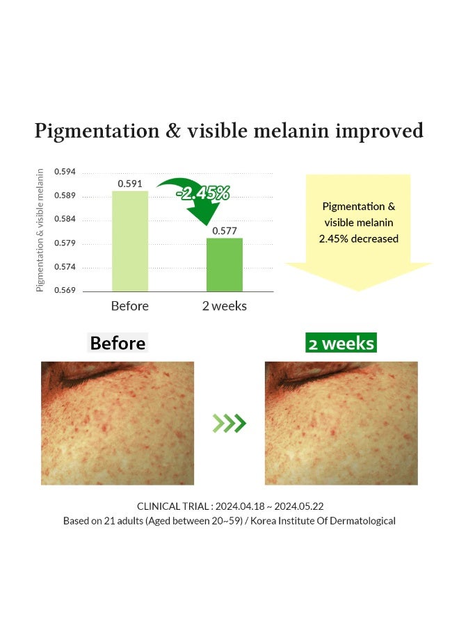Dr.althea Dr. Althea Gentle Vitamin C Serum 30ml - Image 5