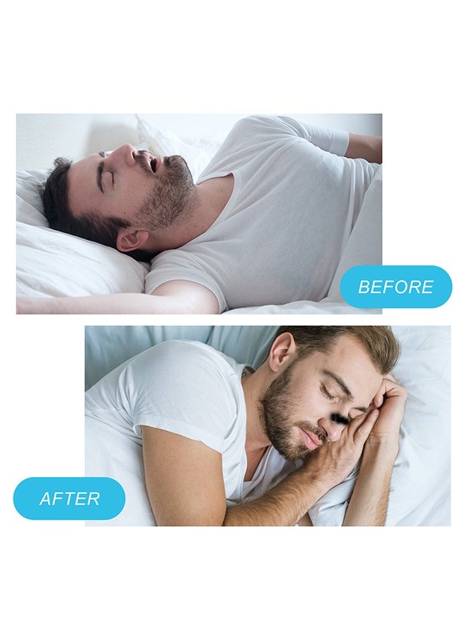 Generic - Starter Kit, Sleep and Sport Nasal Dilator, Anti-snoring Nose Patch Comfortable Anti-snoring Device Suitable for Hotels, Homes, Business Travel, Round Nasal Breathing Dilators Start #Black - Image 1