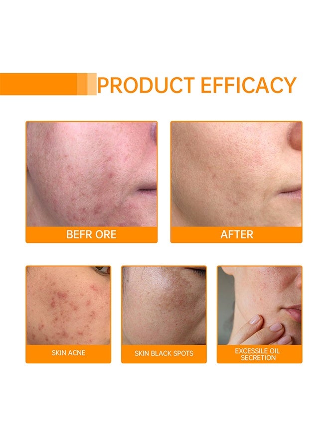 SHIFAKOU Kojic Acid & Turmeric Cleansing Pads for Dark Spots Turmeric Kojic Acid Cleansing Pads Helps Balance Skin Oil & Water Fade Spot Remove Excess Keratin Clean Oil Refines Pores - 50Pcs - Image 3