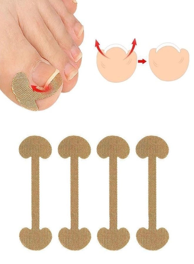 مجموعة ماديا المكونة من 5 قطع (20 شريطًا) لتصحيح الأظافر الغائرة والمنحنية، أداة للعناية بالقدمين، مشبك أظافر، ضمادات تصحيحية لعلاج الأظافر الغائرة، أداة رفع أظافر غير مؤلمة للنساء والرجال - Image 2