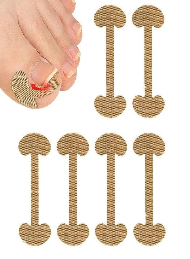 مجموعة ماديا المكونة من 5 قطع (20 شريطًا) لتصحيح الأظافر الغائرة والمنحنية، أداة للعناية بالقدمين، مشبك أظافر، ضمادات تصحيحية لعلاج الأظافر الغائرة، أداة رفع أظافر غير مؤلمة للنساء والرجال - Image 1