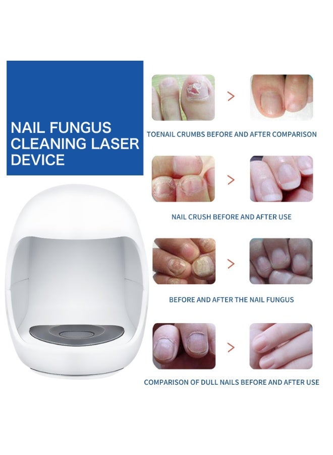 Comprehensive Nail Therapy System - Treatment for Yellowing, Ingrown, and Brittle Nails,mini body easy to carry - Image 3