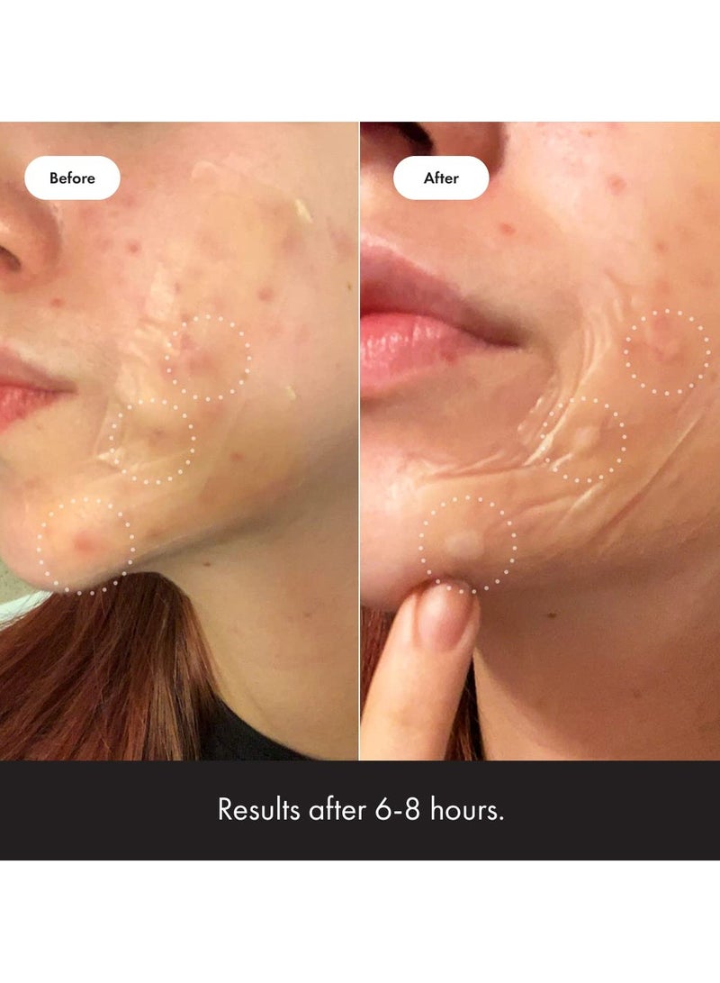 مايتي باتش سطح من Hero Cosmetics - Hydrocolloid Spot Patch للجسم والخد والجبهة والذكنة ، صديقة للنباتيين (10 عدد) - Image 5