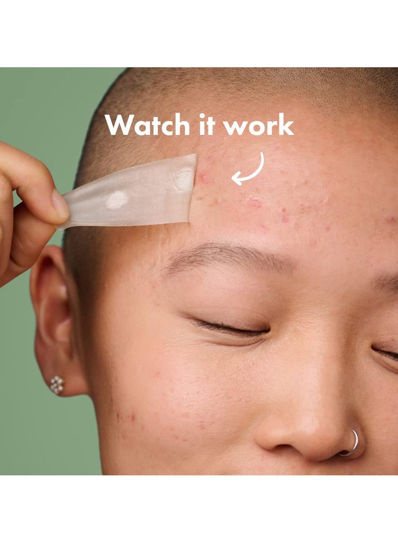 مايتي باتش سطح من Hero Cosmetics - Hydrocolloid Spot Patch للجسم والخد والجبهة والذكنة ، صديقة للنباتيين (10 عدد) - Image 4