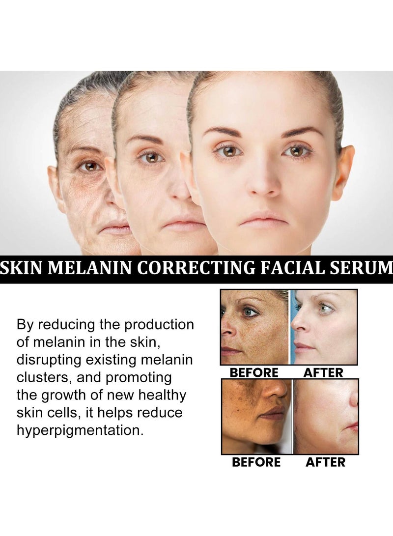 إيلهو سيروم للوجه لتصحيح الميلانين للبشرة 30 مل - Image 4