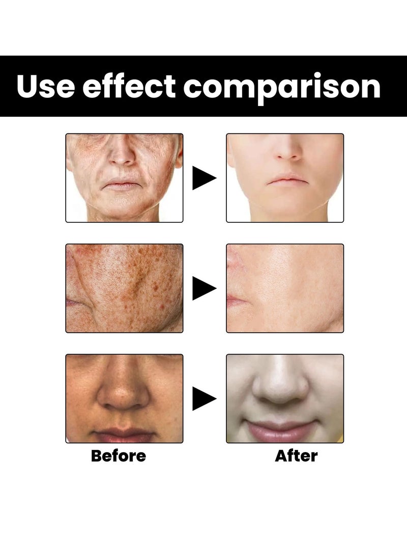 إيلهو سيروم للوجه لتصحيح الميلانين للبشرة 30 مل - Image 2