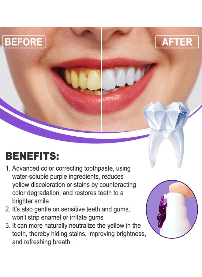 OUHOE - V34 Teeth Colour Corrector Serum 30ml, Formula With Purple Corrector, Cancel Out The Yellow Tones, Remove The Unpleasant Stains and Bring Out Your Teeth Natural Radiance, Make Your Smile Look Bright - Image 1