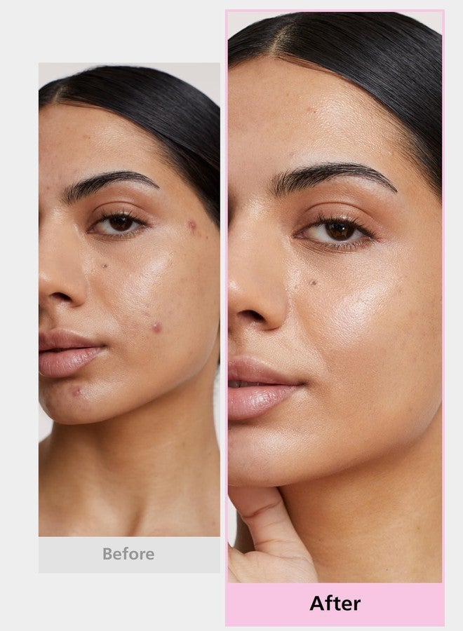 DWEasyDerm مجموعة هدايا لصقات إيزيديرم من دايوونغ للأدوية، مستلزمات الصيف والسفر - Image 4