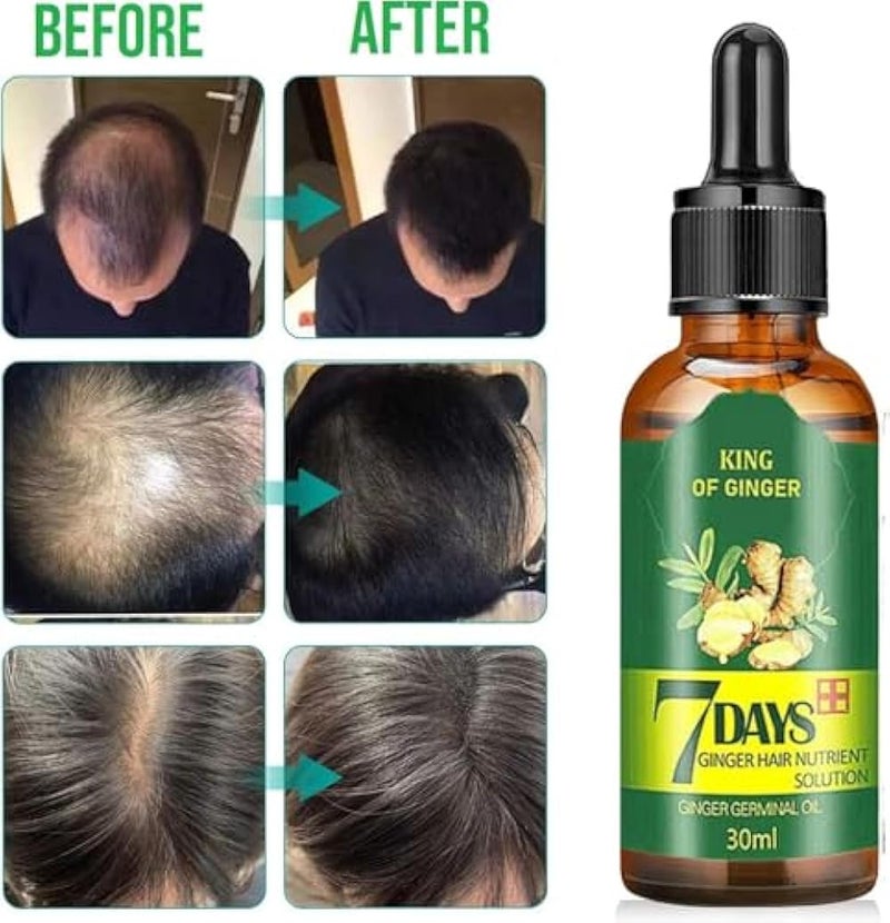 Hair Regrowth Serum, Ginger Essential Oil & Germ Serum for Hair Loss Treatment-For Longer Growth (30ml) - Image 4