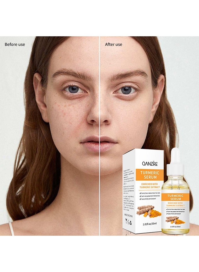QANZIRE Turmeric Serum 30ml - Dark Spot Correcting Serum For Face And Body - Reduces Hyperpigmentation Age Spots - Sun Spots And Improves Skin Tone For Women And Men Of All Skin Types - Image 1