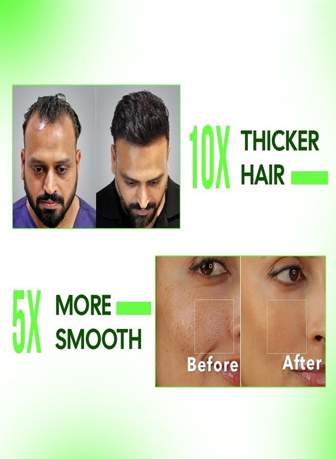 CAREMIMA by SKINROTH 540 Softest Microneedle (0.5mm) Derma Roller | Food-Grade Stainless Steel Needle Derma Tool for Face & Beard Care | Compact Design for Skincare & Haircare - Image 3
