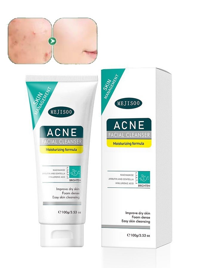 MEJISOO Acne Facial Clwanser，Centella Asiatica Soothing Face Cleanser ，Oil Control Anti-Acne ，Deep Pore Clean Facial Hydrating Moisturizing  100ml - Image 1