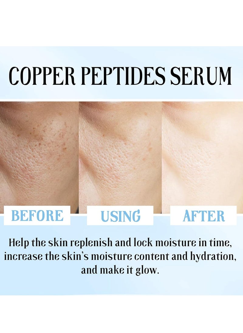 Hoygi Blue Copper Peptide Face Serums, Anti Wrinkle Improves Damaged Skin, Copper Peptides for Face, Glow Serum for Radiant, Hyaluronic Acid Serum Reduces Fine Lines, Improves Skin Barrier 30ml  - Image 4