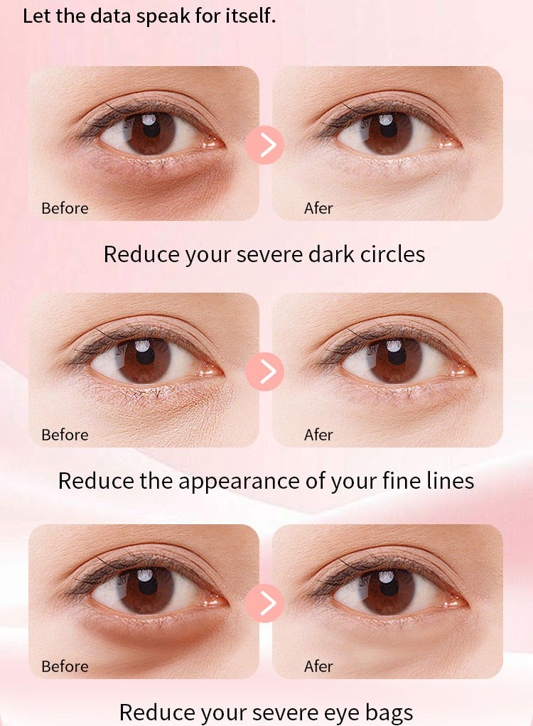 MOOYAM Collagen Eye Cream, Collagen Lifting and Firming, Anti-Aging Moisturizing Smoothing Lightweight Face Cream, Reduce Dark Circles, Diminish Under Eye Bags 100g - Image 5