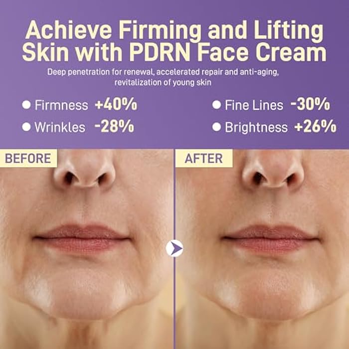 +1HEROLABS PDRN Anti-Aging Face Moisturizer Cream with 5% Squalane,100% Pure PDRN Salmon DNA,Hyaluronic Acid & B5, Firming, Hydrating, Moisturizing Repair Face & Neck Skincare Cream for All Skin,1.85 Fl Oz - Image 5