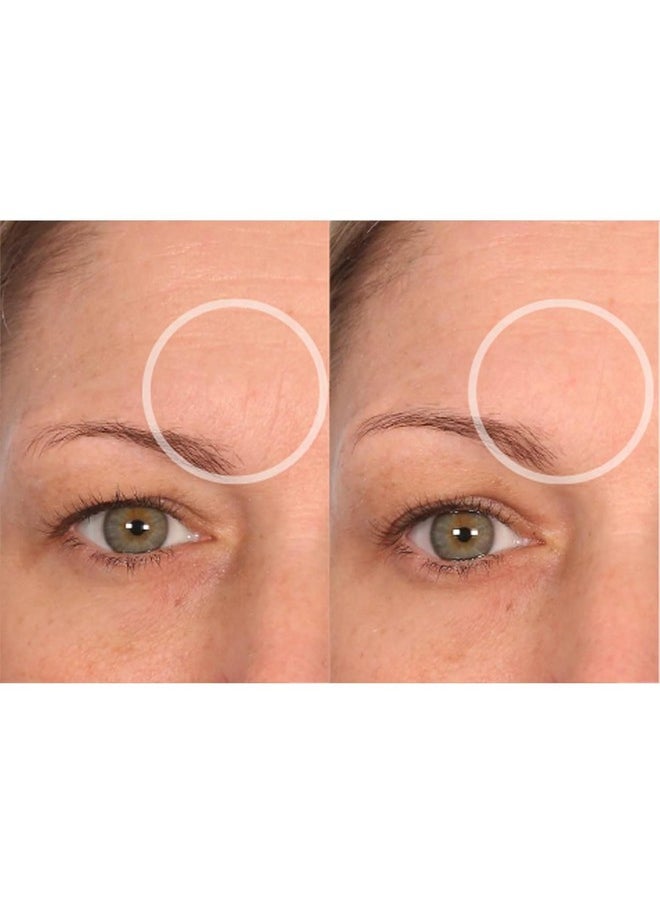 Sio - SiO Beauty BrowLift Forehead Anti-Wrinkle Patch - Expression Line Smoothing - Medical-Grade Silicone for Overnight Wrinkle Reduction & Anti-Aging Hydration, Reusable (10x) - Image 1