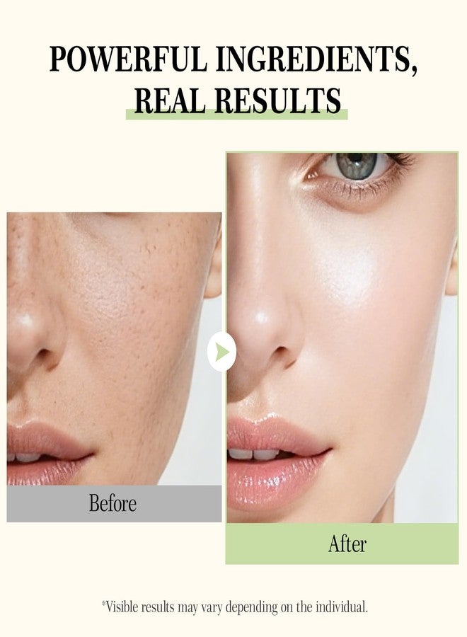 IREV 345 Relief Cream, Face Moisturizer For Soothing And Blemish Care With Vitamin C, Ceramidenp, Face Cream Skin Care For All Skin Types - Image 3