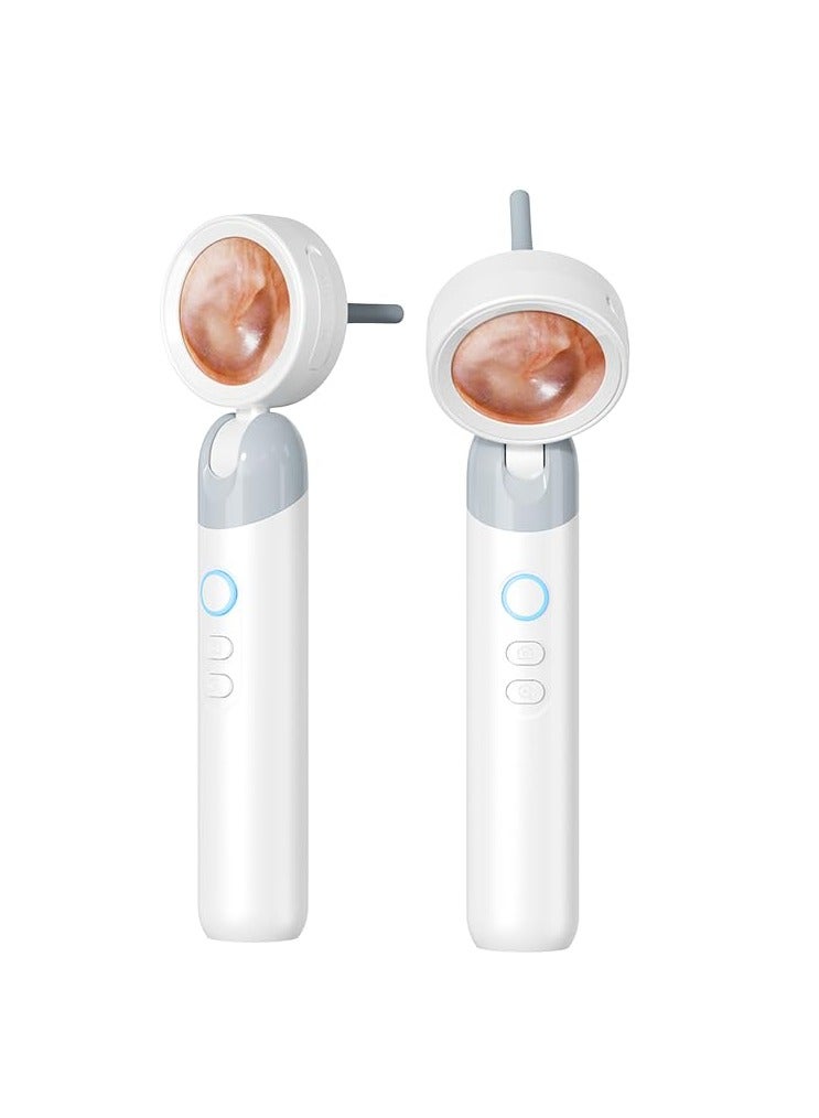 TEKNOWORTH Wireless Digital Otoscope with Screen - Ear mouth and nose camera - Video Otoscope Ear Cleaner Camera with Light for Kids & Adults - ENT Scope for Ear Wax Removal - USB Ear Scope Compatible with Windows & Mac  - Image 1