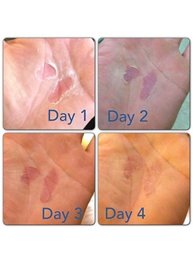 ريب فيكس RipFix Hand Tear Repair - بلسم Rip Fix Stopper للجمباز - بلسم يدين للمتسلقين - العناية باليدين بالكالو الخشبي - كريم بلسم إصلاح اليدين للتسلق - علاج للأيدي المتشققة أو الممزقة، عبوة كلاسيكية سعة 1.34 أونصة - Image 5