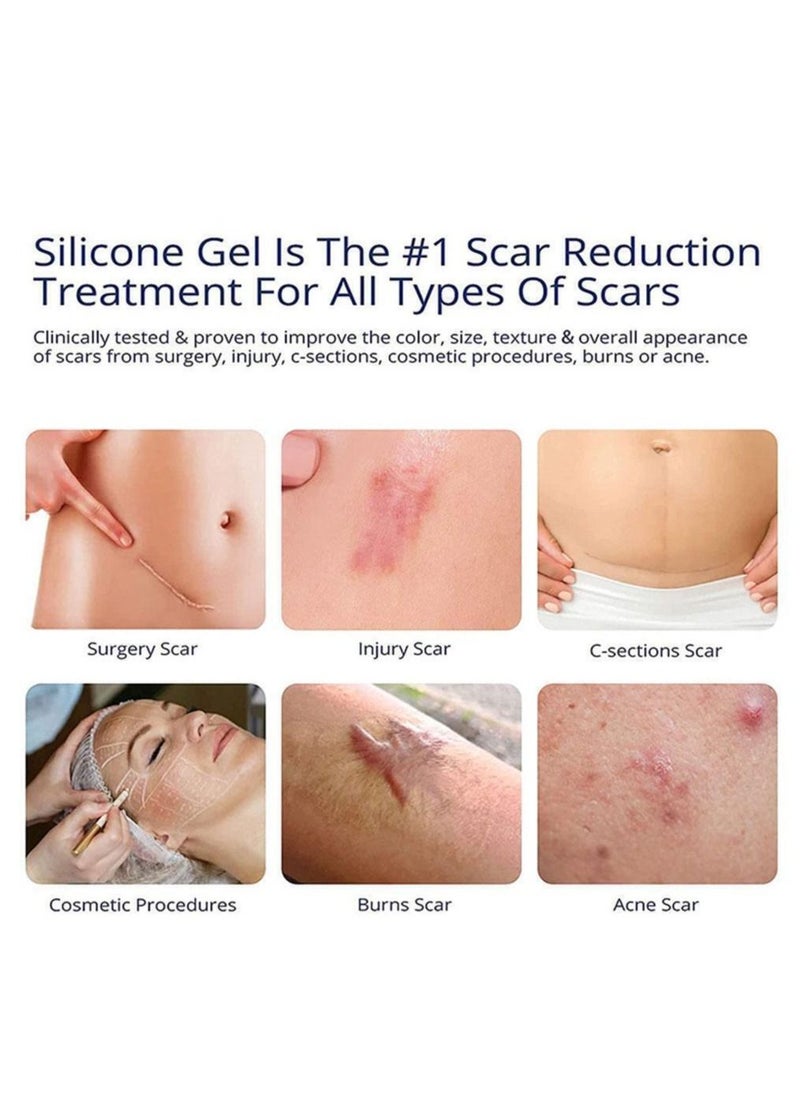 ASMOXA Advanced Scar Removal Gel Medical Grade Scar Gel for Surgical Scars Acne C-Section Tummy Tuck Stretch Mark Burns Face Heals Smooths Renews Hydrates Skin Repair Gel for all Skin Types 30g  - Image 4