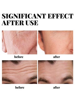 EELHOE Men's Anti Aging Face Cream Collagen Retinol, Vitamin E Brightening and Moisturizing Face Creamfade Fine Lines, 30g  - Image 5