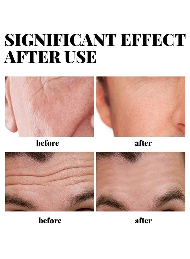 EELHOE Men's Anti Aging Face Cream Collagen Retinol, Vitamin E Brightening and Moisturizing Face Creamfade Fine Lines, 30g - Image 5