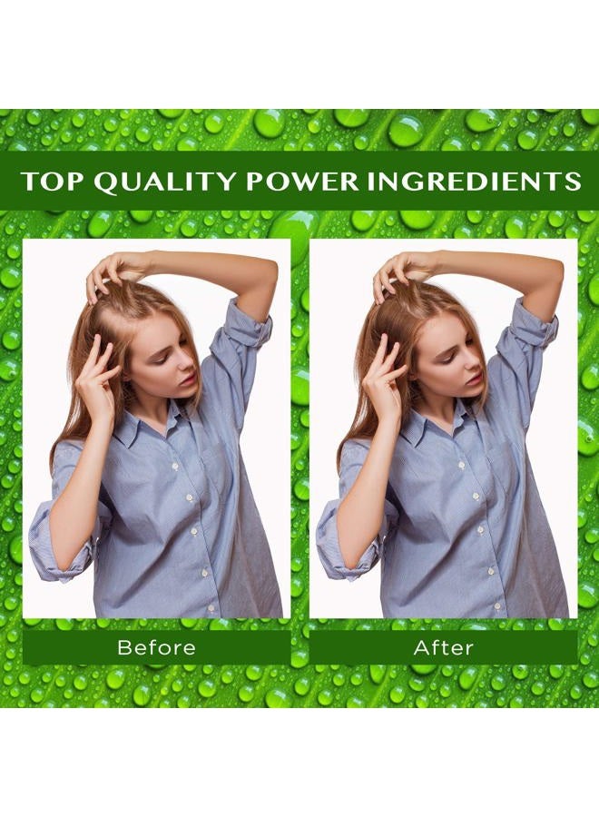 EssyNaturals Advanced Essynaturals Hair Growth Oil with Biotin - Caffeine and Castor Oil for Fuller, Thicker, Longer Hair - Image 4