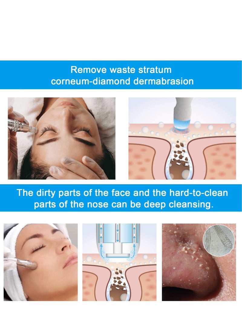 Excefore - Diamond Microdermabrasion Machine, Professional Dermabrasion Equipment for Facial Skin Care, for Skin Exfoliating, Blackhead Whitehead Removal - Image 1