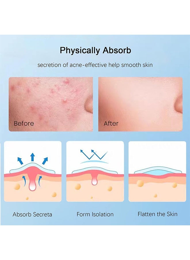 JS Acne Pimple Patches, Hydrocolloid Acne Patch for Covering Face, Blemishes, Zits Absorbing Patch, Cosmetics Patch for Pimple Dots, Acne Treatment, Invisible Acne Spot Patches (150 Count) - Image 2