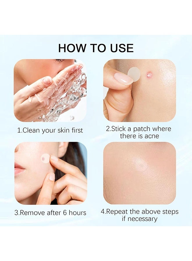 JS Acne Pimple Patches, Hydrocolloid Acne Patch for Covering Face, Blemishes, Zits Absorbing Patch, Cosmetics Patch for Pimple Dots, Acne Treatment, Invisible Acne Spot Patches (150 Count) - Image 3