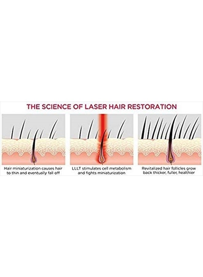 iRestore Essential Laser Hair Growth System + Rechargeable Battery Pack - FDA Cleared Hair Growth for Men & Hair Loss Treatments for Women with Thinning Hair, Hair Regrowth for Women - Image 3