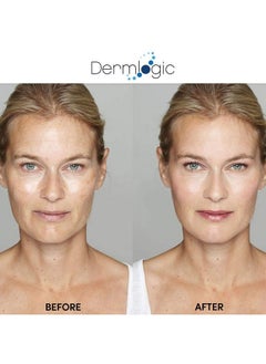 Dermlogic Anti Aging Resurfacing Peel Pads Contains Salicylic Glycolic & Lactic For Face & Body. Includes Hyaluronic & Witch Hazel Green Tea & Aloe Vera. Exfoliates To Correct Dark Spots & Scars.  - Image 4