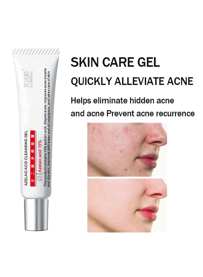 فو شيتينج جل منظف حمض الأزيليك ، حمض الأزيليك 15٪ كريم حب الشباب ، كريم حب الشباب للوجه ، علاج البقع ، جل مضاد لحب الشباب للبشرة المعرضة للبقع ، الوردية التي تقلل من تخفيف البثور ، تصبغ الرؤوس السوداء والاحمرار ، ترطيب 15 جم - Image 2